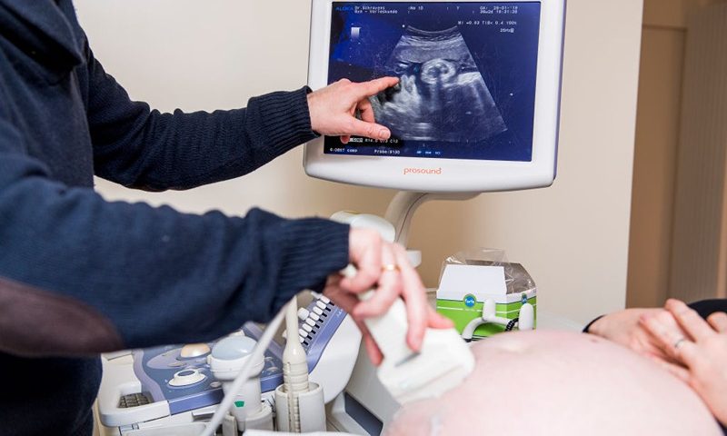 Illustration picture shows a doctor doing an ultrasound examination during a visit of a pregnant woman to her gynaecologist, in Mechelen, Thursday 31 January 2019. BELGA PHOTO JASPER JACOBS (Photo credit should read JASPER JACOBS/AFP via Getty Images)