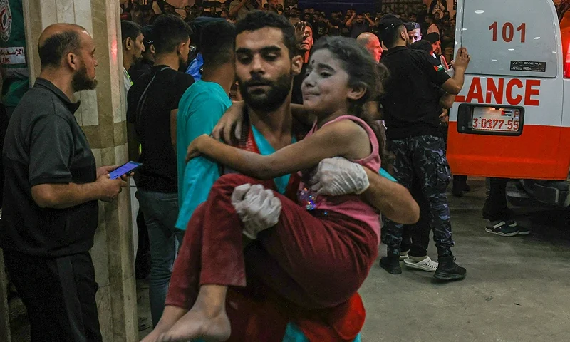 EDITORS NOTE: Graphic content / A Palestinian child injured in an Israeli air strike is carried inside the Nasser hospital in Khan Yunis in the southern of Gaza Strip, on October 17, 2023. Thousands of people, both Israeli and Palestinians have died since October 7, 2023, after Palestinian Hamas militants based in the Gaza Strip, entered southern Israel in a surprise attack leading Israel to declare war on Hamas in Gaza on October 8. (Photo by Mahmud HAMS / AFP) (Photo by MAHMUD HAMS/AFP via Getty Images)