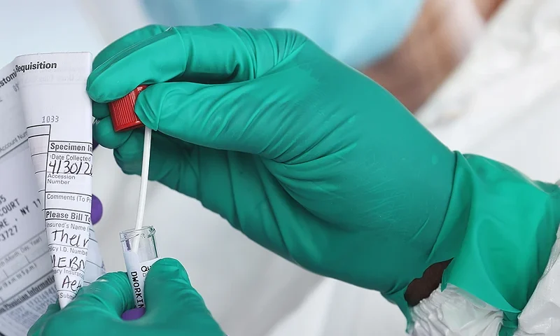 A Health Care Worker seals a coronavirus swab after testing at the Pro Health Urgent Care coronavirus testing site on April 30, 2020 in Wantagh, New York. (Photo by Al Bello/Getty Images)