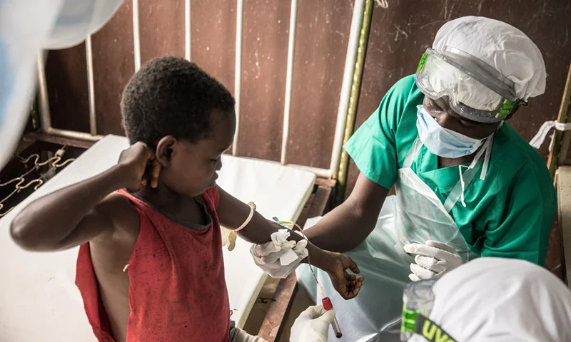 Blood samples are drawn from a boy who didn't display any sign of monkeypox despite his all family has been contaminated, while at a quarantine area of the centre of the International medical NGO Doctors Without Borders (Medecins sans frontieres - MSF), in Zomea Kaka, in the Lobaya region, in the Central African Republic on October 18, 2018. Monkeypox is a contagious disease, without remedy, which heals itself, but who can kill if not treated in time. Since May 2018, the monkeypox virus, which spreads in tropical Africa, has become a "public health threat" in the Central African Republic, according to the Pasteur Institute of Bangui. (Photo by CHARLES BOUESSEL / AFP) (Photo by CHARLES BOUESSEL/AFP via Getty Images)