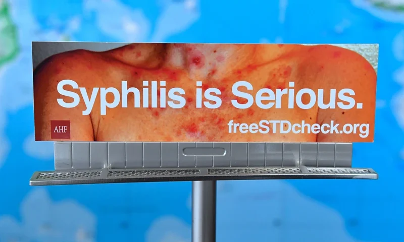 A model of a billboard from the AIDS Healthcare Foundation (AHF) which ran in Los Angeles earlier this year but has been rejected to be displayed in many other cities is seen at the AHF office in Hollywood, California on May 18, 2018. - A billboard on Sunset Boulevard in Hollywood screams out a stark warning: "drug-resistant gonorrhea alert!" Sexually transmitted diseases have made an alarming resurgence across the US, where 2016 saw a record two million cases of chlamydia, gonorrhea and syphilis, including 628 cases of congenital syphilis. But California, the most populous US state, stands out for its willingness to tackle the crisis head-on, with cases of the three ailments up 45 percent in 2017 from five years ago. (Photo by Frederic J. BROWN / AFP) / TO GO WITH AFP STORY by Javier TOVAR, "California on front line as STDs run rampant in US" (Photo credit should read FREDERIC J. BROWN/AFP via Getty Images)