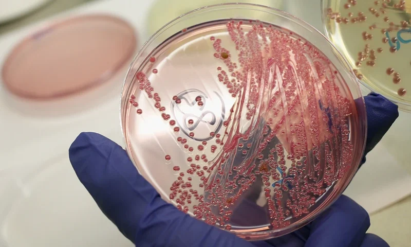 HAMBURG, GERMANY - JUNE 02: A lab technician holds a bacteria culture that shows a positive infection of enterohemorrhagic E. coli, also known as the EHEC bacteria, from a patient at the University Medical Center Hamburg-Eppendorf on June 2, 2011 in Hamburg, Germany. German health authorities are continung to grapple with the current outbreak of EHEC and claim that initial suspicions of cucumbers from Spain as being the source are unfounded, though they warn against consuming raw vegetables. The University Medical Center has the highest number of patients infected with EHEC as well as 102 patients who have come down with hemolytic-uremic syndrome (HUS), a complication that can lead to kidney failure, convulsions and epileptic seizures and is caused by EHEC. Authorites are reporting at least 2,000 cases of EHEC infection nationwide and at least 470 cases of HUS. Across Europe at least 17 people have died from the outbreak. (Photo by Sean Gallup/Getty Images)