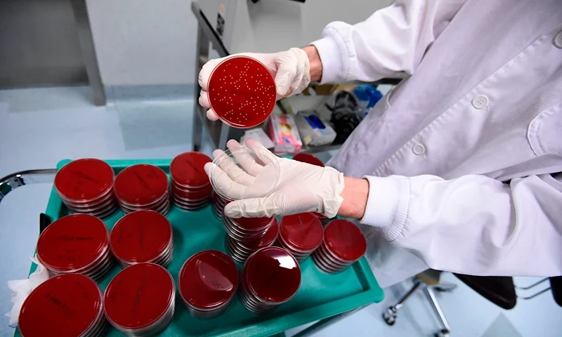 A scientific staff shows synthetic blood platelets in protected little containers used for testing to check the filtering level and to evaluate the presence of microbes on surgical masks in an operating room transformed into a laboratory, at the Policlinico Sant'Orsola-Malpighi hospital in Bologna on April 15, 2020, during a lockdown aimed at curbing the spread of the COVID-19 pandemic, caused by the novel coronavirus. - This laboratory is the only one in Italy that tests protections for medical use according to the European standard. (Photo by Miguel MEDINA / AFP) (Photo by MIGUEL MEDINA/AFP via Getty Images)
