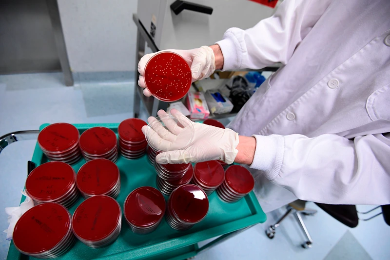 A scientific staff shows synthetic blood platelets in protected little containers used for testing to check the filtering level and to evaluate the presence of microbes on surgical masks in an operating room transformed into a laboratory, at the Policlinico Sant'Orsola-Malpighi hospital in Bologna on April 15, 2020, during a lockdown aimed at curbing the spread of the COVID-19 pandemic, caused by the novel coronavirus. - This laboratory is the only one in Italy that tests protections for medical use according to the European standard. (Photo by Miguel MEDINA / AFP) (Photo by MIGUEL MEDINA/AFP via Getty Images)